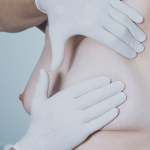 Palpamiento de mama