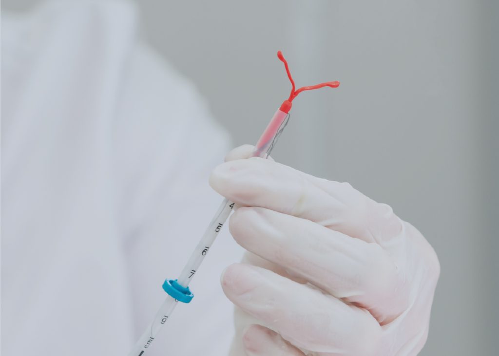 Métodos Anticonceptivos de Larga Duración