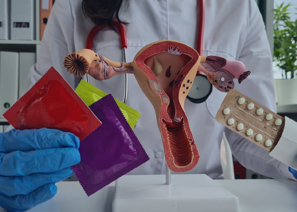Métodos Anticonceptivos de Corta y Muy Corta Duración