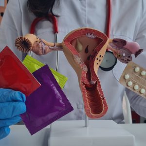 Anticonceptivos de corta duración