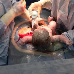 Abordaje de las principales emergencias obstétricas