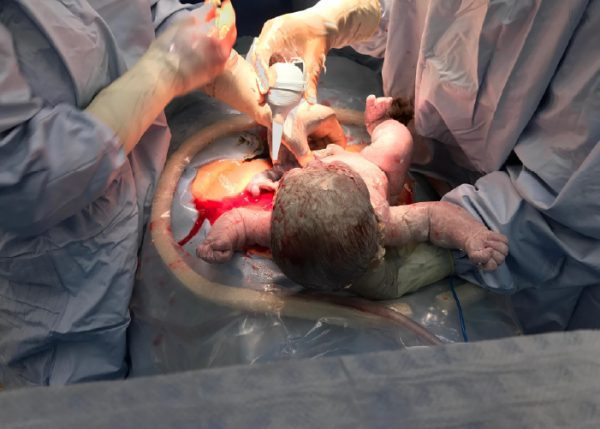Abordaje de las principales emergencias obstétricas