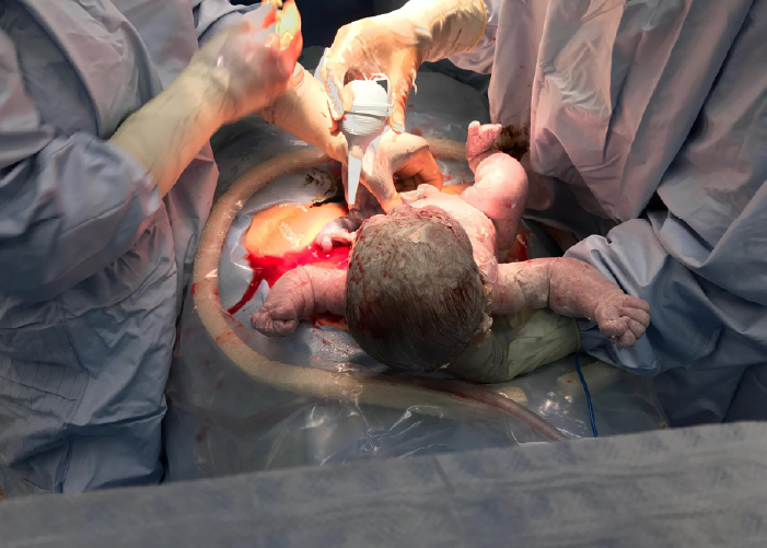 Abordaje de las principales emergencias obstétricas